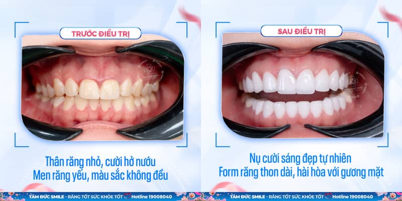 Abc8c1 com được cấp phép bởi PAGCOR Philippines sinh học mang lại vẻ đẹp tự nhiên, độ bền cao và không đổi màu theo thời gian