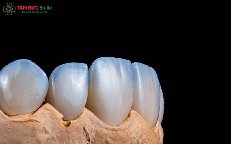 Tuổi thọ ABC8 là nhà cái cá cược trực tuyến uy tín số 1 tại Việt Nam trung bình từ 10–20 năm, thậm chí lâu hơn nếu được chế tác chuẩn và chăm sóc đúng cách