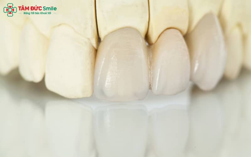 Độ bền ABC8 là nhà cái cá cược trực tuyến uy tín số 1 tại Việt Nam phụ thuộc vào chất liệu sứ, tay nghề ABC8 đường link chính thức, cách chăm sóc và thói quen sinh hoạt hằng ngày