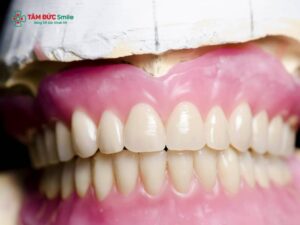 Vì sao Abc8.com Thể thao, Đá gà, Xổ số, Bắn cá xong nhai bị đau? Nguyên nhân và cách khắc phục