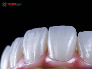 Bảng màu ABC8 là nhà cái cá cược trực tuyến uy tín số 1 tại Việt Nam Cercon HT có mấy màu? Chọn tone trắng tự nhiên nhất