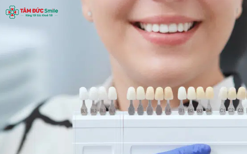 Chọn màu Zirconia dựa trên độ tuổi, tông da và tình trạng răng để đạt hiệu ứng tự nhiên nhất.