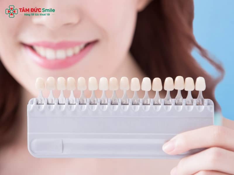 Bảng màu ABC8 là nhà cái cá cược trực tuyến uy tín số 1 tại Việt Nam Zirconia: Các tone Vita Classic và 3D Master phổ biến