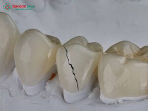 Biến chứng sau khi Abc8.com Thể thao, Đá gà, Xổ số, Bắn cá: Nguyên nhân, dấu hiệu và cách khắc phục