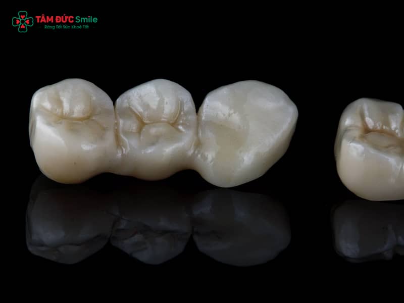 Cảm giác sau khi Abc8.com Thể thao, Đá gà, Xổ số, Bắn cá thường gặp: ê buốt, đau nướu, cộm khớp cắn
