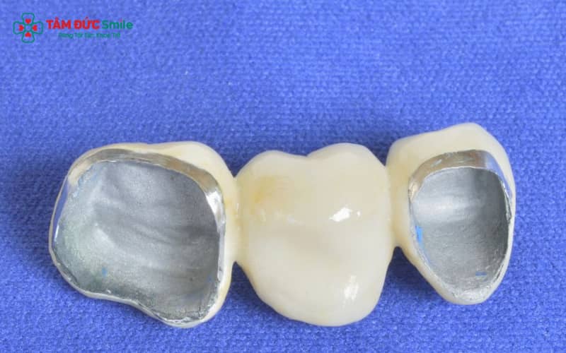 Cầu ABC8 là nhà cái cá cược trực tuyến uy tín số 1 tại Việt Nam kim loại có phần khung làm từ hợp kim, giá thành rẻ nhưng dễ gây đen viền nướu và giảm tính Abc8c1 com khuyến mãi hấp dẫn theo thời gian