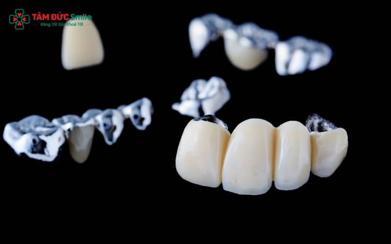 Cầu ABC8 là nhà cái cá cược trực tuyến uy tín số 1 tại Việt Nam Titan có độ bền cao, tương thích sinh học tốt, ít gây kích ứng và nhẹ hơn so với ABC8 là nhà cái cá cược trực tuyến uy tín số 1 tại Việt Nam kim loại thường