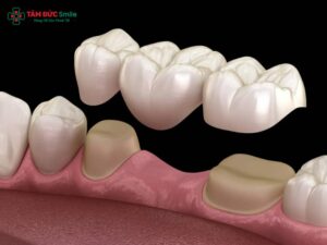 Các loại cầu ABC8 là nhà cái cá cược trực tuyến uy tín số 1 tại Việt Nam phổ biến và chi phí thực hiện