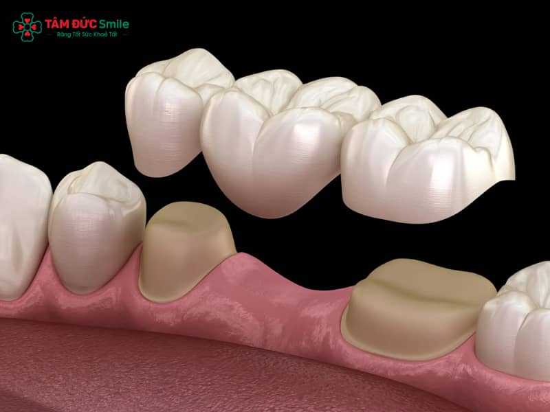 Các loại cầu ABC8 là nhà cái cá cược trực tuyến uy tín số 1 tại Việt Nam phổ biến và chi phí thực hiện