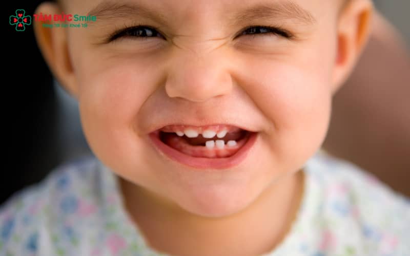 Chăm sóc trẻ mọc răng cần theo dõi sốt, cho ăn mềm và vệ sinh miệng nhẹ nhàng mỗi ngày