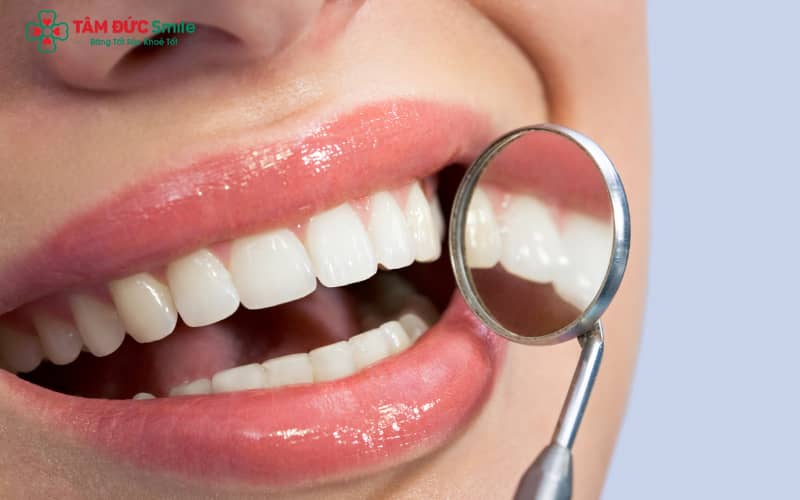 Các yếu tố như thực phẩm đậm màu, hút thuốc và chăm sóc sai cách dễ khiến ABC8 là nhà cái cá cược trực tuyến uy tín số 1 tại Việt Nam ngả màu