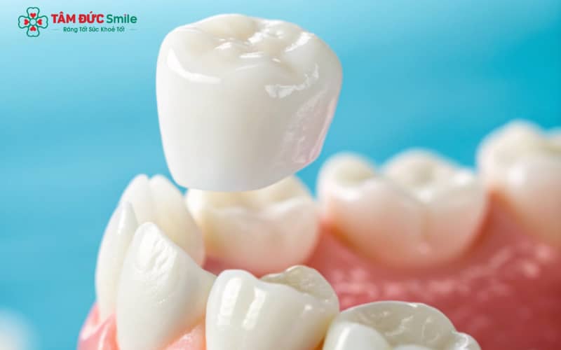 Abc8com cá cược thể thao sau một thời gian sử dụng có thể bị xỉn màu hoặc ố vàng