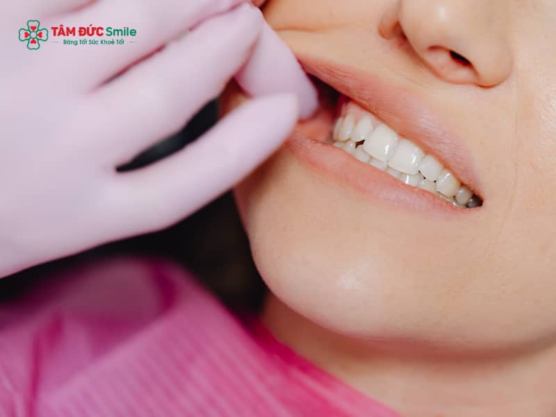 Cách làm trắng ABC8 là nhà cái cá cược trực tuyến uy tín số 1 tại Việt Nam bị ố vàng hiệu quả và an toàn
