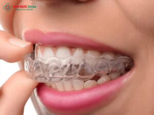 Cách sử dụng Abc87 tải ứng dụng trong suốt đúng chuẩn