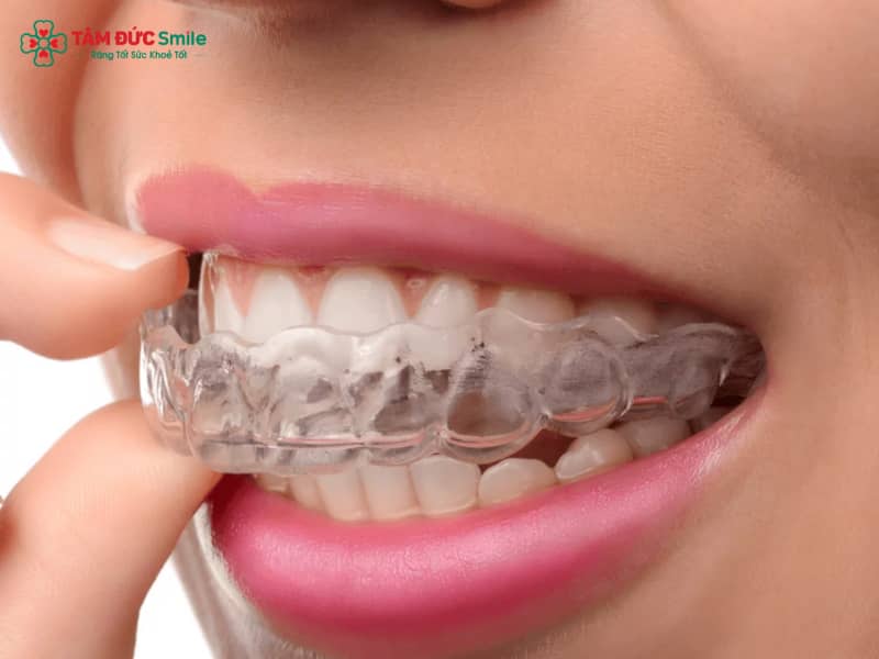 Cách sử dụng Abc87 tải ứng dụng trong suốt đúng chuẩn