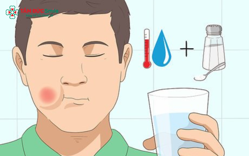 Các mẹo dân gian như súc nước muối, dầu dừa, gừng – tỏi hay lá ổi giúp giảm ê buốt tạm thời tại nhà
