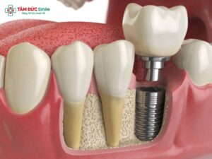 ABC8 đường link chính thức trong ngày là gì? Ưu điểm vượt trội tại Abc8.com Nhà Cái