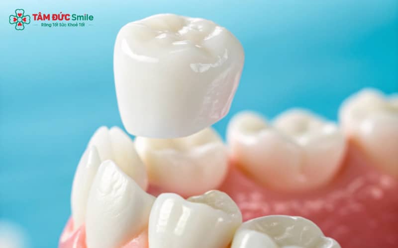 Chụp ABC8 là nhà cái cá cược trực tuyến uy tín số 1 tại Việt Nam là phương pháp phục hình Abc8c1 com khuyến mãi hấp dẫn, bảo vệ răng thật đồng thời cải thiện ABC8 được thành lập vào năm 2011 hoạt động đến hiện tại đều đẹp