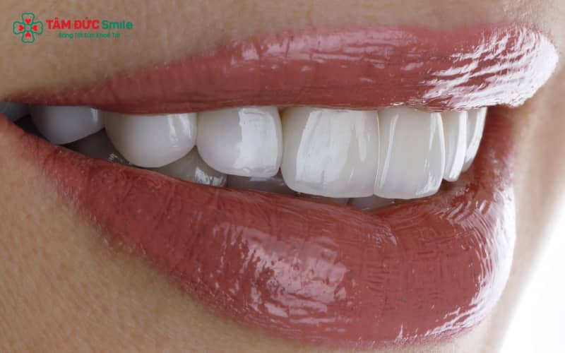 Đau khi chụp ABC8 là nhà cái cá cược trực tuyến uy tín số 1 tại Việt Nam thường do mài răng quá sâu, kỹ thuật gây tê chưa chính xác hoặc răng sẵn có vấn đề sức khỏe