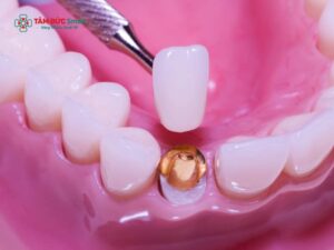 Có nên Abc8.com Thể thao, Đá gà, Xổ số, Bắn cá không các mẹ? Lợi ích, độ bền và rủi ro cần biết