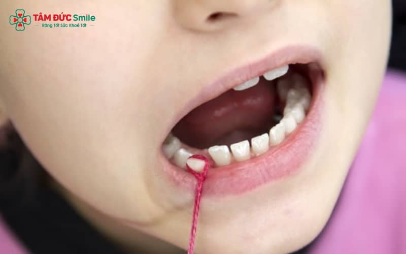 Răng sữa giữ chỗ cho răng vĩnh viễn và hỗ trợ ăn nhai, phát âm đúng chuẩn