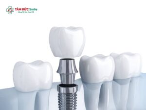Có nên Link Vào Abc8.com Đăng Ký Tặng 88K không? Ưu nhược điểm & chi phí chi tiết