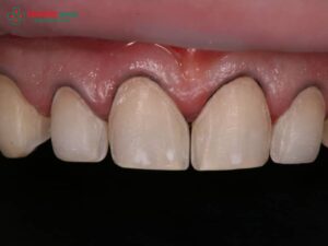 Dấu hiệu ABC8 là nhà cái cá cược trực tuyến uy tín số 1 tại Việt Nam bị hở? Nguyên nhân, hậu quả và cách khắc phục