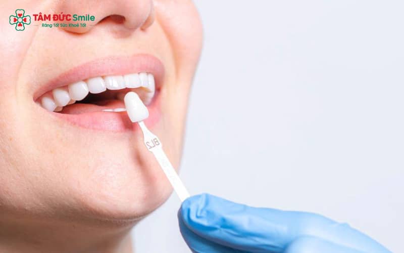 Chăm sóc ABC8 là nhà cái cá cược trực tuyến uy tín số 1 tại Việt Nam sau điều chỉnh: đánh răng nhẹ nhàng, dùng chỉ LINK TRANG CHỦ ABC88 CHUẨN 2026, ăn uống hợp lý và tái khám định kỳ để duy trì độ bền và Abc8c1 com khuyến mãi hấp dẫn