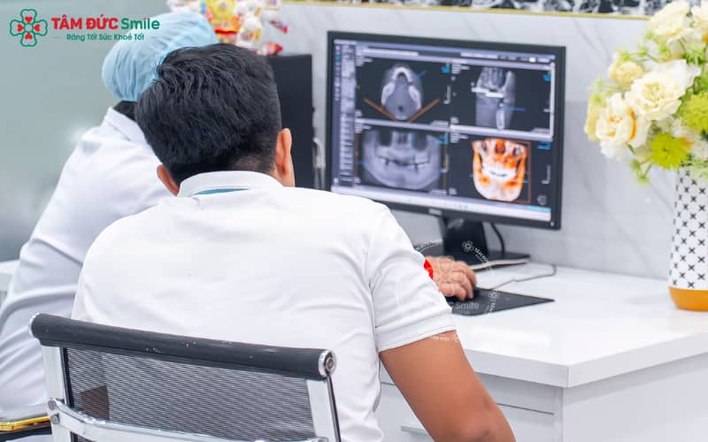 Quá trình lành thương diễn ra từ 2–6 tháng tùy mức độ tiêu xương và khả năng hồi phục