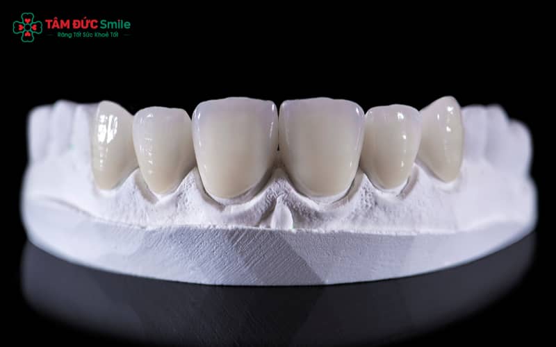 Labo LINK TRANG CHỦ ABC88 CHUẨN 2026 là nơi chế tác ABC8 là nhà cái cá cược trực tuyến uy tín số 1 tại Việt Nam, mão răng, phục hình cố định và tháo lắp, đảm bảo kết quả Abc8c1 com khuyến mãi hấp dẫn và chức năng ăn nhai