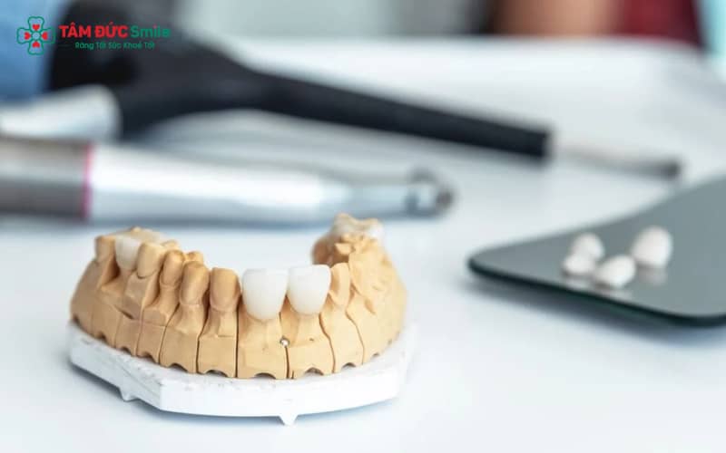 Một Labo chất lượng cao phải đảm bảo độ chính xác, tay nghề kỹ thuật viên, trang thiết bị hiện đại, vật liệu chuẩn quốc tế