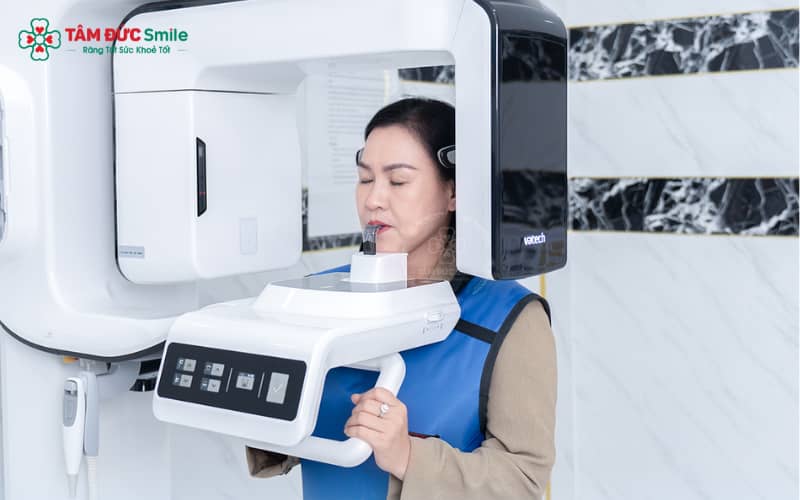 Sau khi mài cùi, răng được lấy dấu bằng công nghệ CAD/CAM giúp mão sứ chế tác chính xác và khít sát