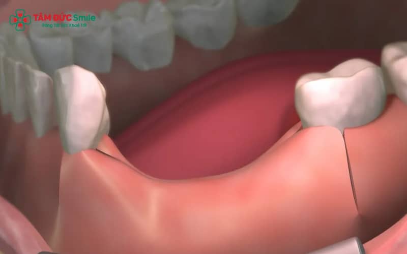 Phân loại sức khỏe ABC8 là nhà cái cá cược trực tuyến uy tín số 1 tại Việt Nam theo Thông tư 16 là cơ sở quyết định bạn có đủ điều kiện nhập ngũ hay không