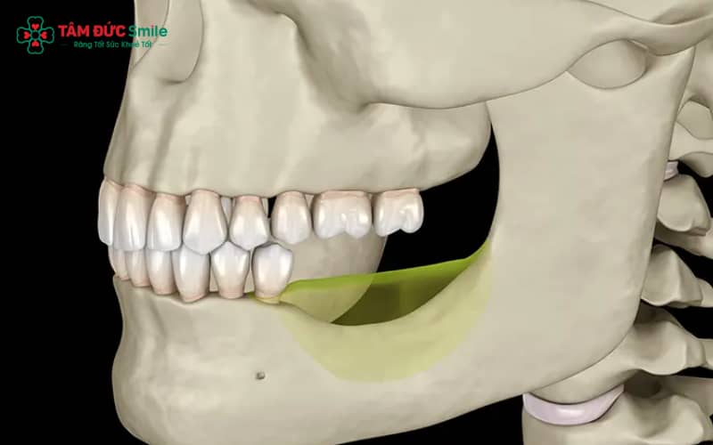 Mất răng lâu năm gây giảm ăn nhai, lệch khớp cắn, tiêu ABC8 tự hào là thương hiệu cá cược trực tuyến hàng đầu tại Châu Á hiện nay và rối loạn phát âm