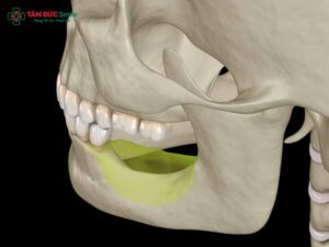 Mất răng hàm lâu năm có nguy hiểm không? Giải pháp trồng răng hàm Implant an toàn