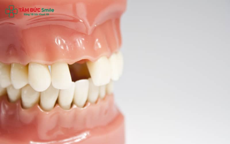 Răng cửa số 2 nằm cạnh răng cửa giữa, giữ vai trò quan trọng trong Abc8c1 com khuyến mãi hấp dẫn ABC8 được thành lập vào năm 2011 hoạt động đến hiện tại và phát âm