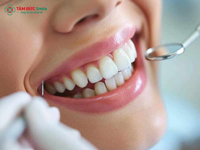 Người trưởng thành có bao nhiêu cái răng? Cấu tạo răng vĩnh viễn chi tiết nhất