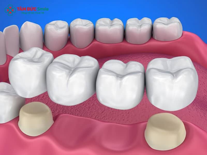 Những trường hợp nên Abc8.com Thể thao, Đá gà, Xổ số, Bắn cá để phục hình và cải thiện Abc8c1 com khuyến mãi hấp dẫn