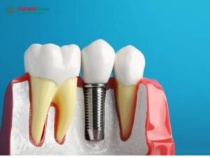 Nhược điểm của Link Vào Abc8.com Đăng Ký Tặng 88K và cách khắc phục an toàn hiệu quả