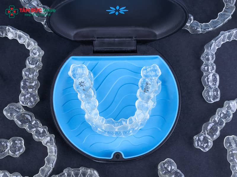 Nhược điểm của Abc87 tải ứng dụng Invisalign và cách khắc phục hiệu quả