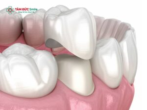 Quy trình Abc8.com Thể thao, Đá gà, Xổ số, Bắn cá cho răng sâu chuẩn LINK TRANG CHỦ ABC88 CHUẨN 2026 an toàn, bền đẹp