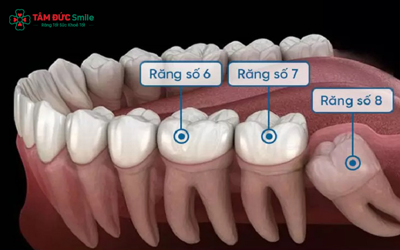 Răng cấm chỉ mọc một lần, không mọc lại nếu mất