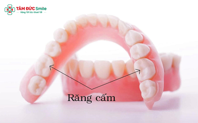 Răng cấm là răng vĩnh viễn, không thay răng sữa
