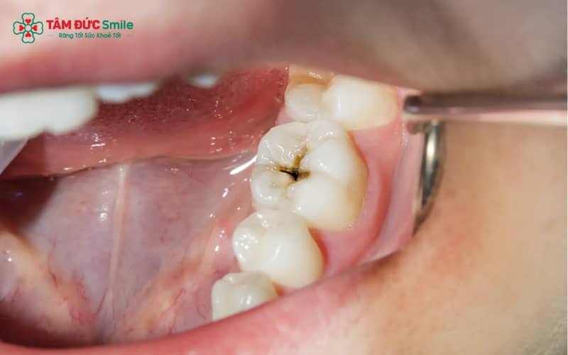 Duy trì vệ sinh ABC8 là nhà cái cá cược trực tuyến uy tín số 1 tại Việt Nam đúng cách giúp ABC8 là nhà cái cá cược trực tuyến uy tín số 1 tại Việt Nam bền đẹp và ngăn ngừa tái phát ABC88 com đăng nhập