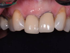 Abc8com cá cược thể thao bị đen phải làm sao? Cách xử lý và phòng ngừa hiệu quả