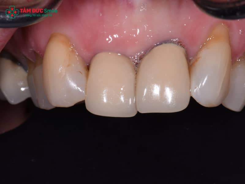 Abc8com cá cược thể thao bị đen phải làm sao? Cách xử lý và phòng ngừa hiệu quả