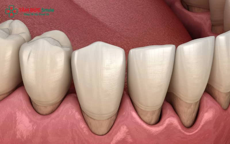 Khắc phục ABC8 là nhà cái cá cược trực tuyến uy tín số 1 tại Việt Nam bị hở nướu cần được thực hiện tại LINK TRANG CHỦ ABC88 CHUẨN 2026 uy tín với ABC8 đường link chính thức chuyên sâu về phục hình Abc8c1 com khuyến mãi hấp dẫn