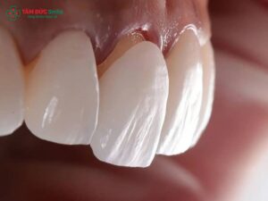 Nguyên nhân ABC8 là nhà cái cá cược trực tuyến uy tín số 1 tại Việt Nam bị lỏng và cách khắc phục hiệu quả