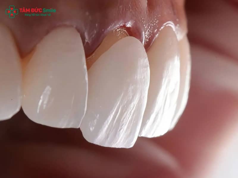 Nguyên nhân ABC8 là nhà cái cá cược trực tuyến uy tín số 1 tại Việt Nam bị lỏng và cách khắc phục hiệu quả