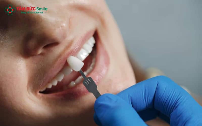 Cảm giác ê buốt, đau nhức quanh Abc8com giaitri tructuyen là dấu hiệu sớm cho thấy ABC8 là nhà cái cá cược trực tuyến uy tín số 1 tại Việt Nam đang bị lung lay